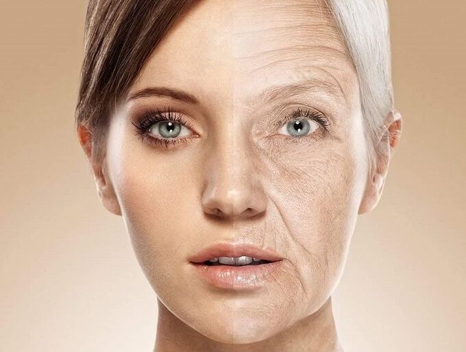 pelle del viso prima e dopo il ringiovanimento laser