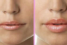 prima e dopo la procedura di restauro del labbro